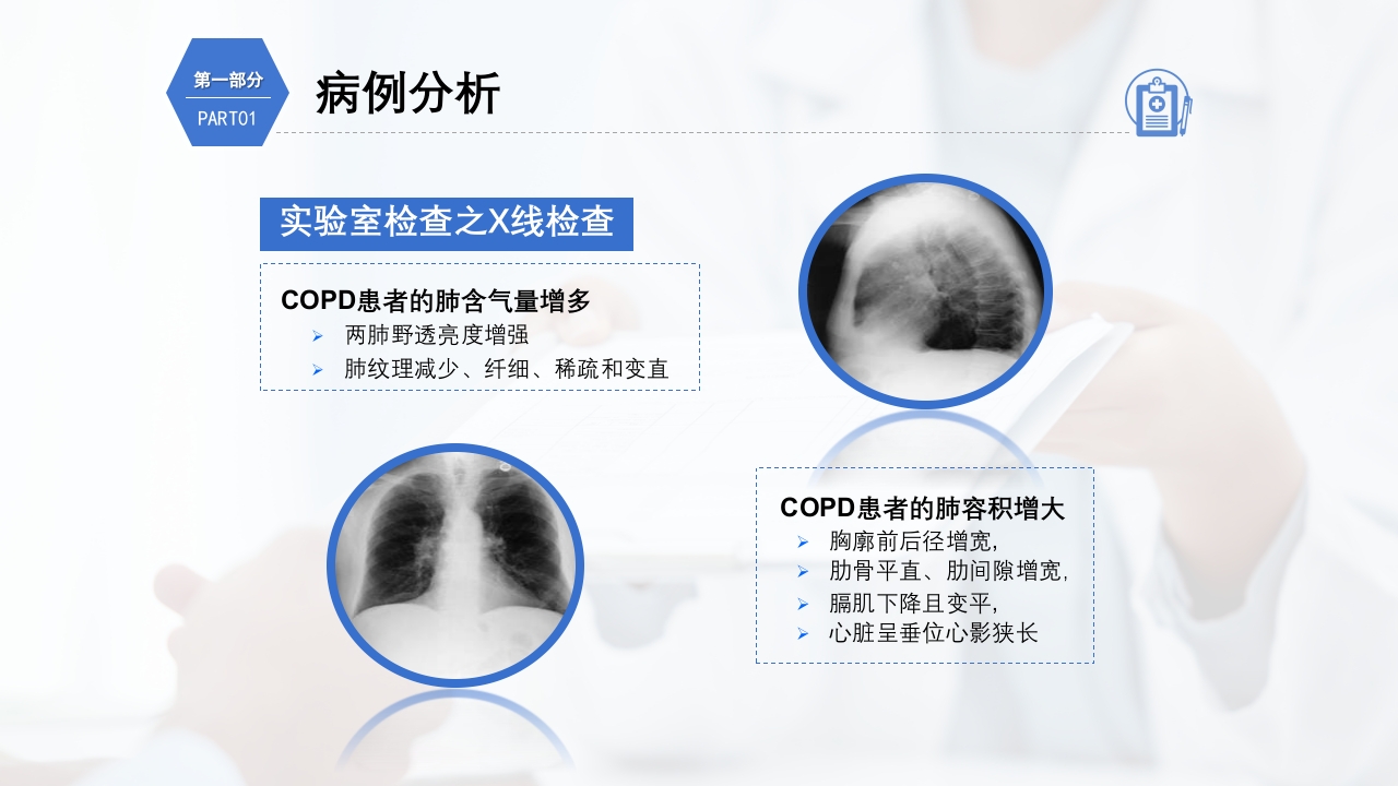 慢性阻塞性肺疾病护理查房PPT课件14