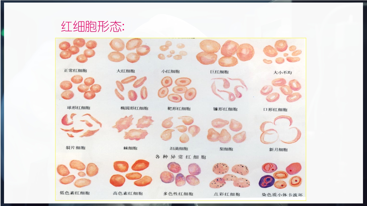 血常规和C反应蛋白检测的临床意义PPT课件44