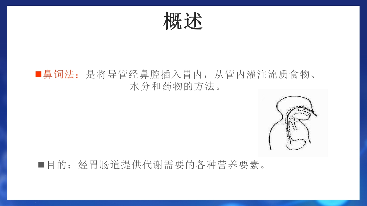 鼻饲患者护理PPT课件3