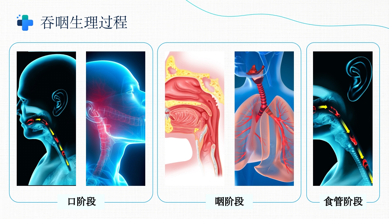 吞咽障碍的康复护理PPT课件5