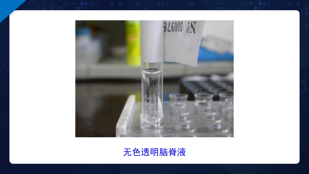 脑脊液检验PPT课件12