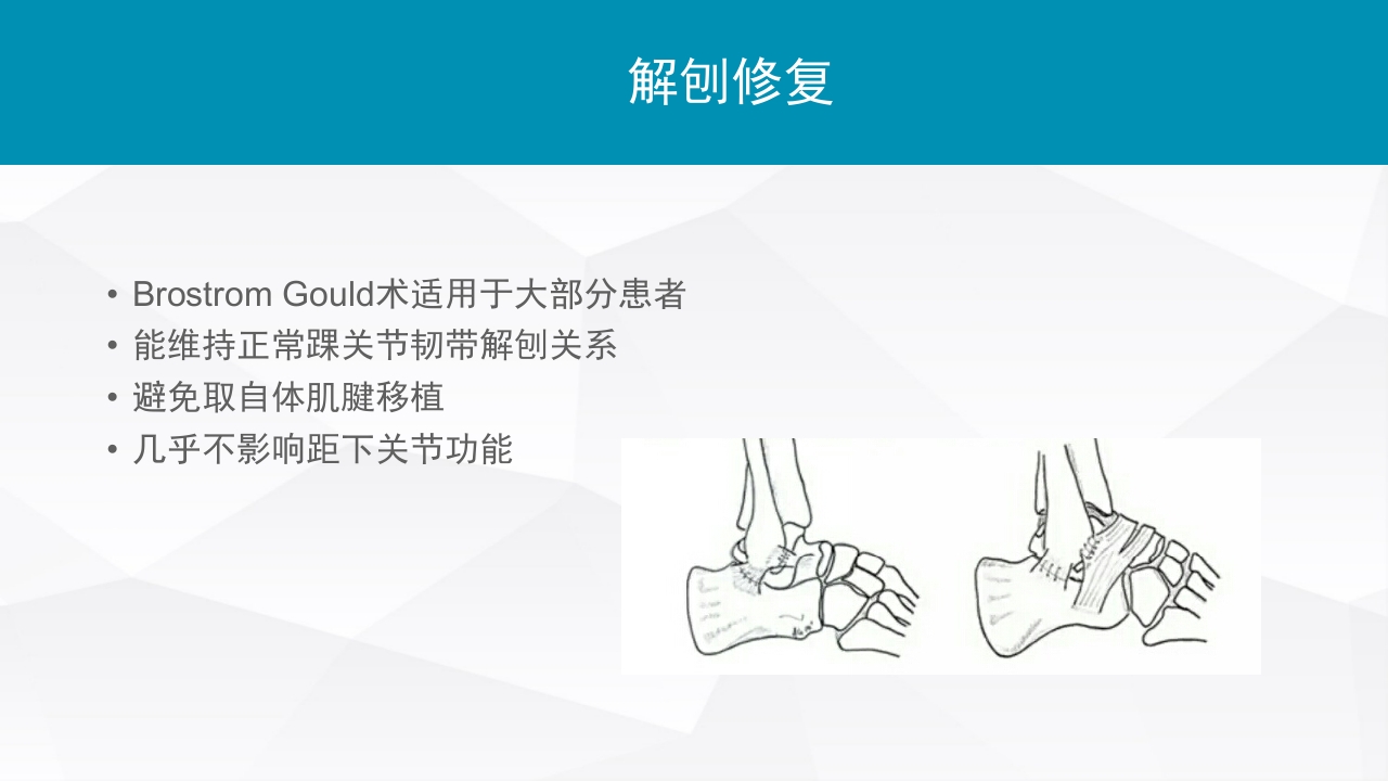 踝关节扭伤的评估和治疗PPT课件14