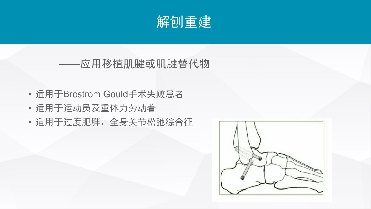 踝关节扭伤的评估和治疗PPT课件15