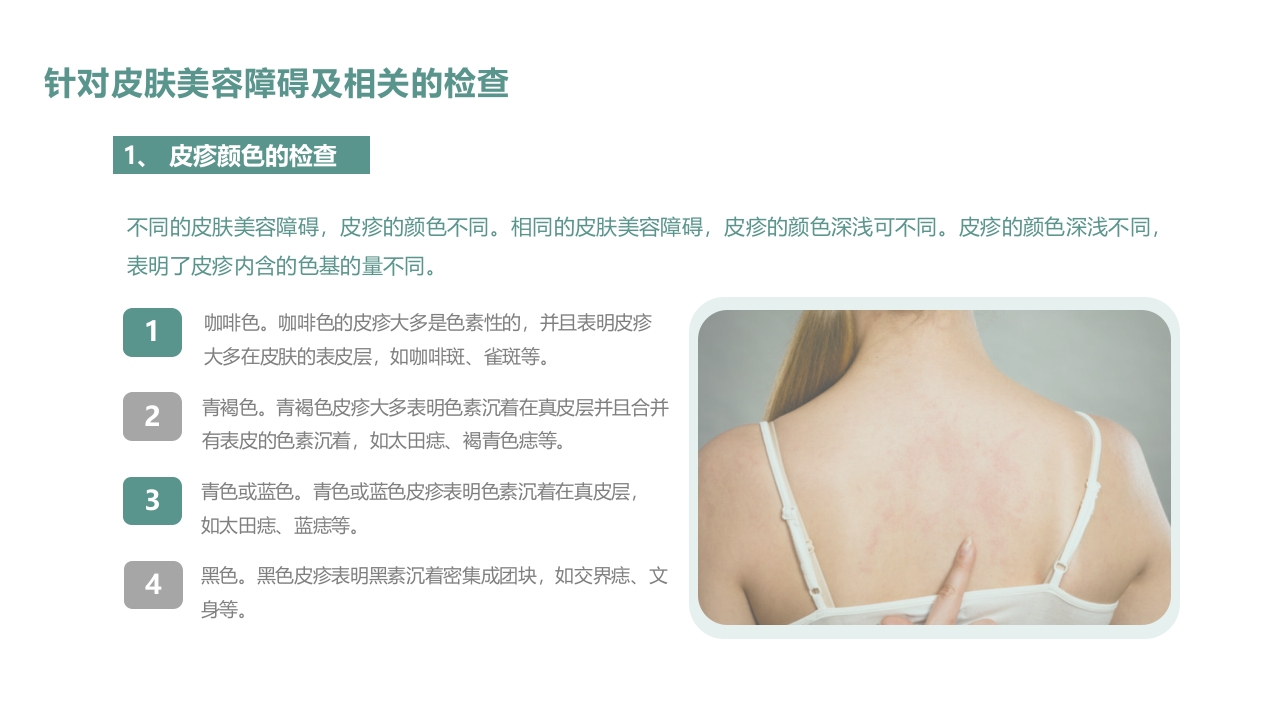 皮肤色素沉着的激光美容治疗PPT课件26