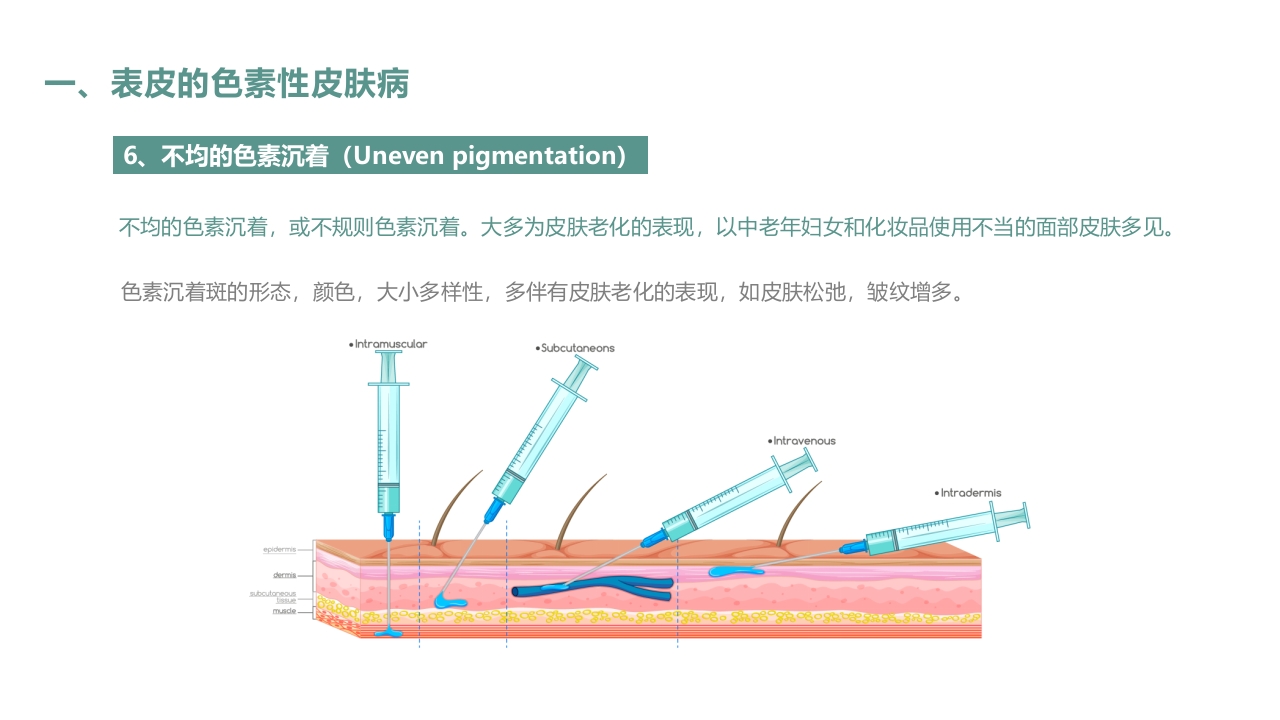 皮肤色素沉着的激光美容治疗PPT课件9
