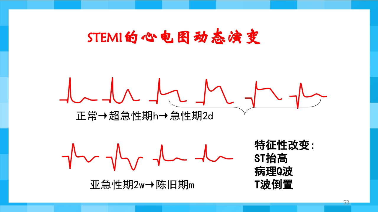 急性冠脉综合征PPT课件53