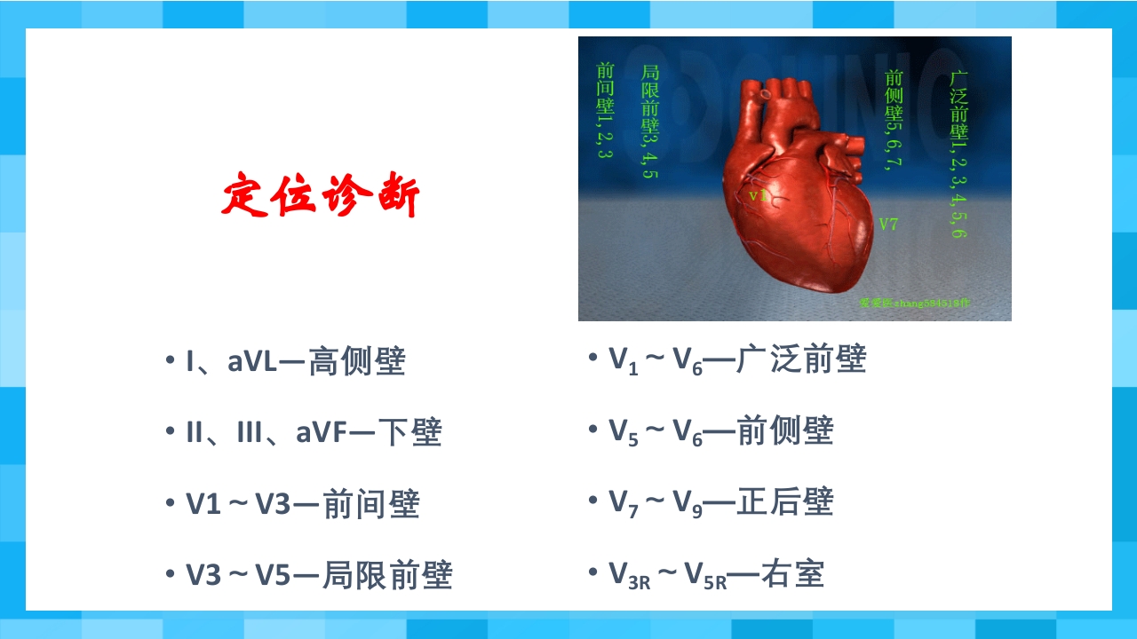 急性冠脉综合征PPT课件54