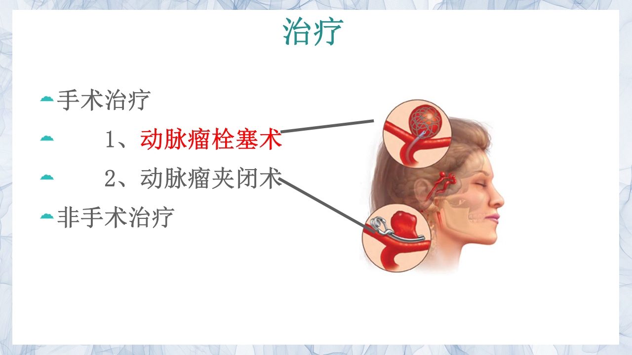 颅内动脉瘤的疾病查房PPT课件28