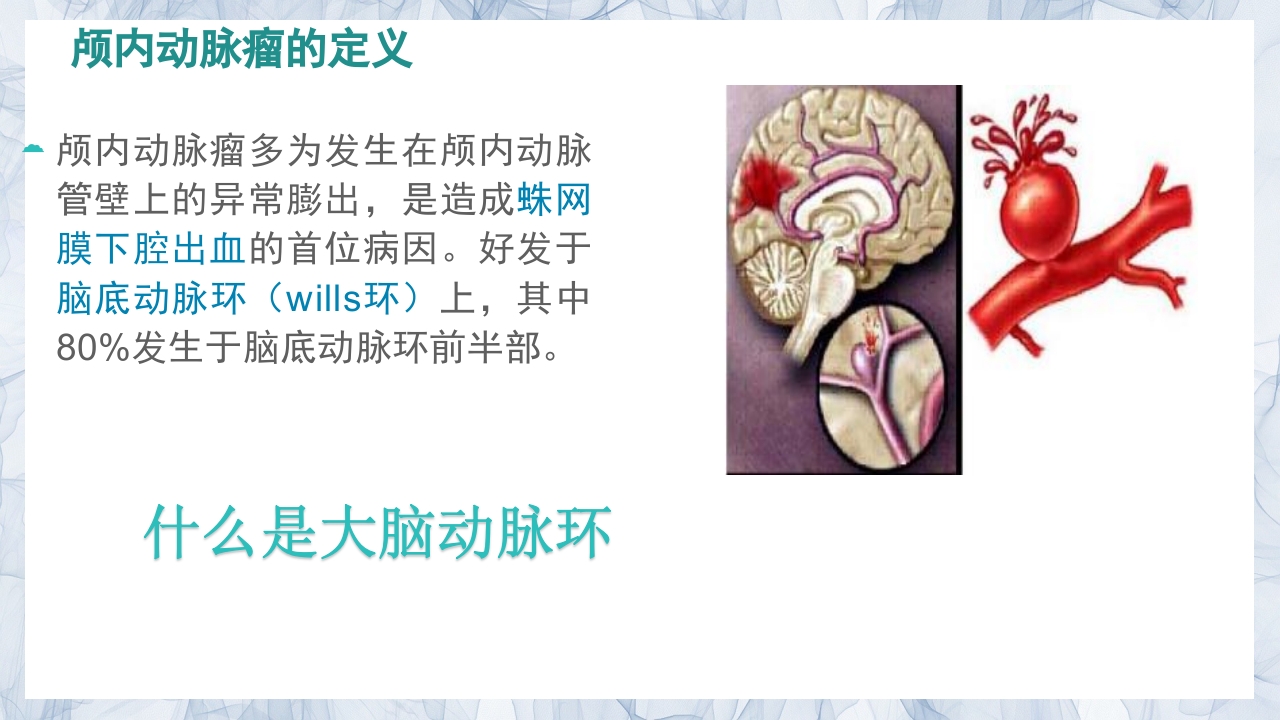 颅内动脉瘤的疾病查房PPT课件6