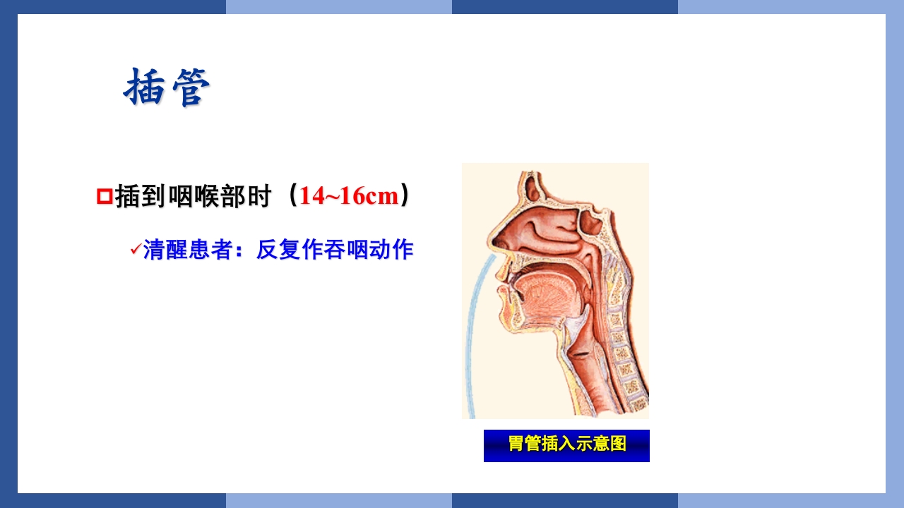 鼻饲、灌肠、导尿术PPT课件11