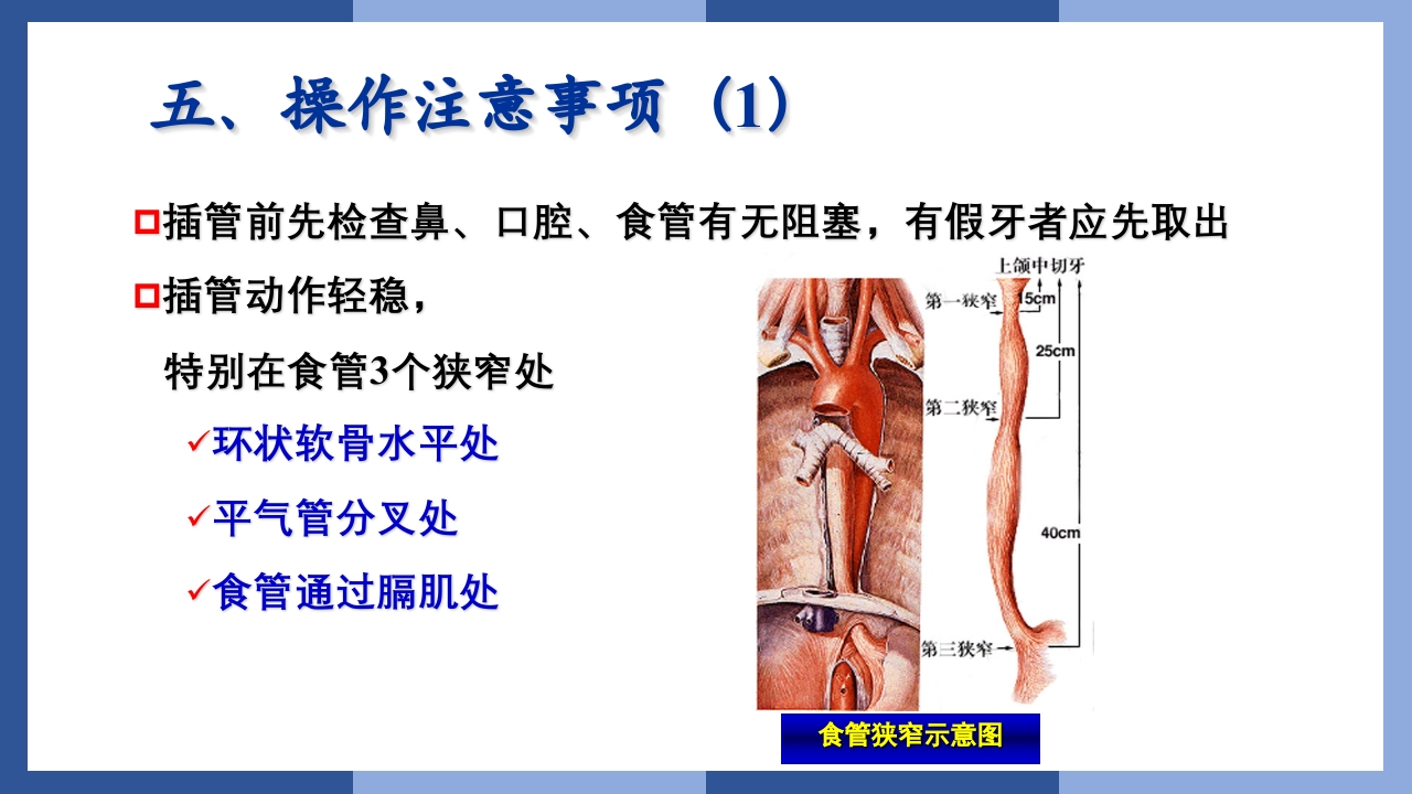 鼻饲、灌肠、导尿术PPT课件18