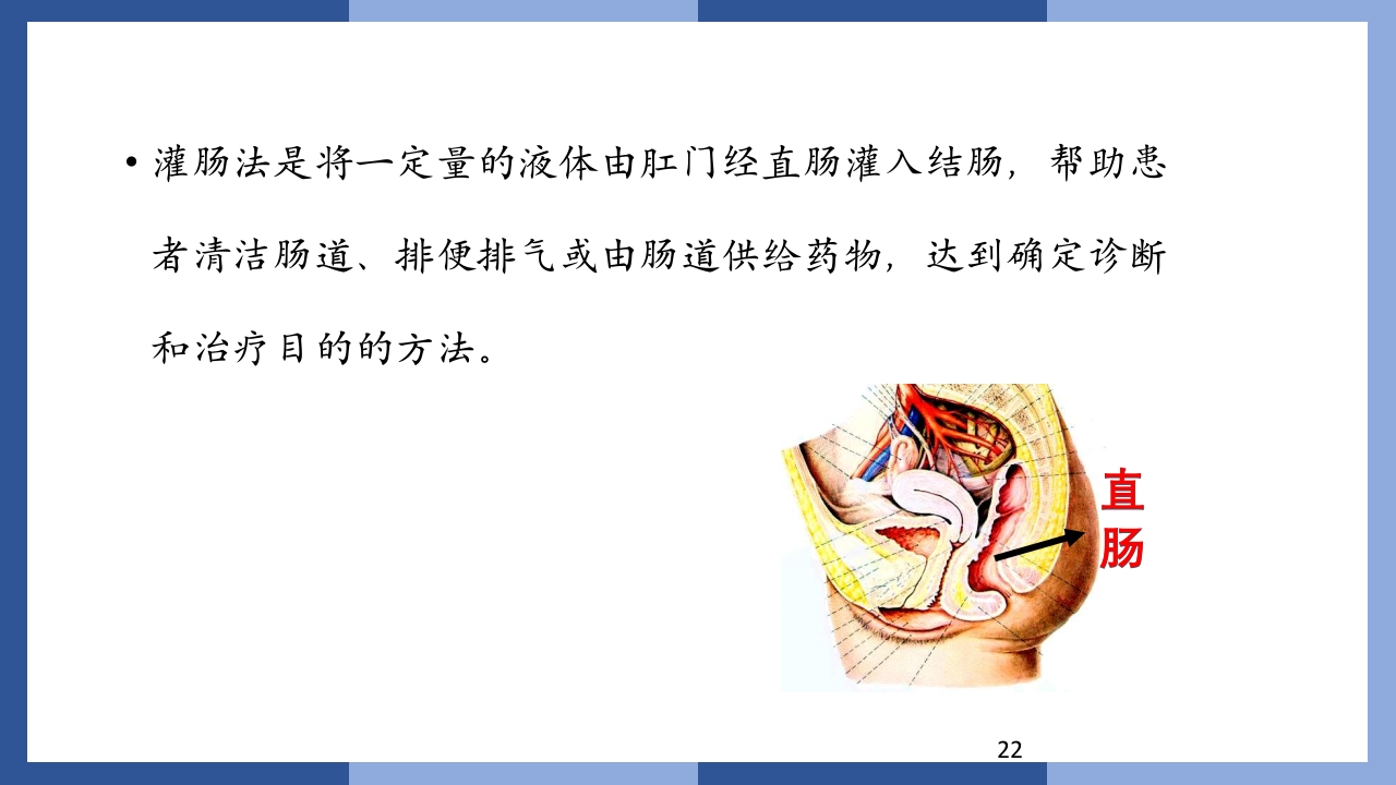 鼻饲、灌肠、导尿术PPT课件22