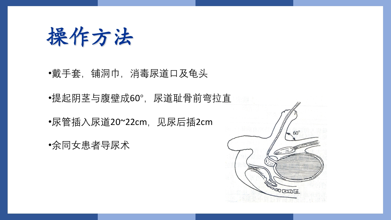 鼻饲、灌肠、导尿术PPT课件55
