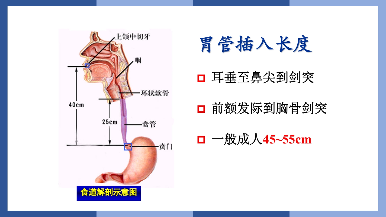 鼻饲、灌肠、导尿术PPT课件9