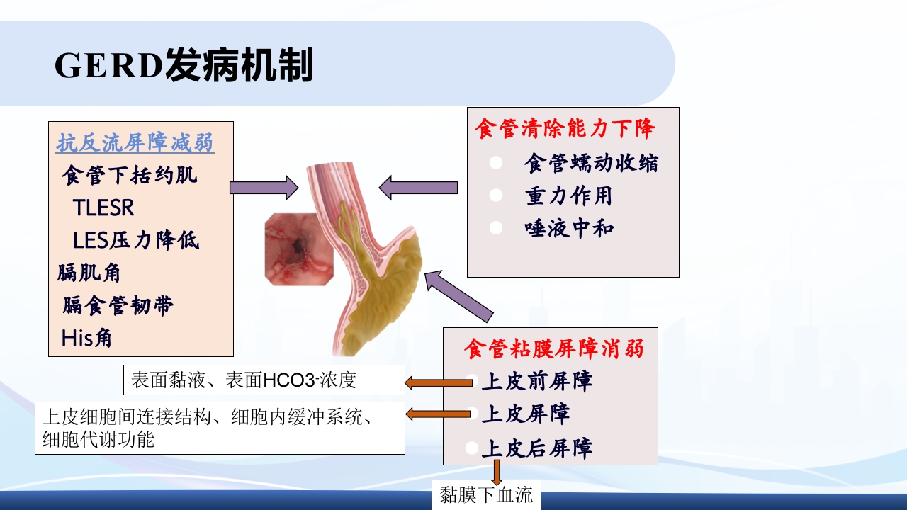胃食管反流PPT课件11