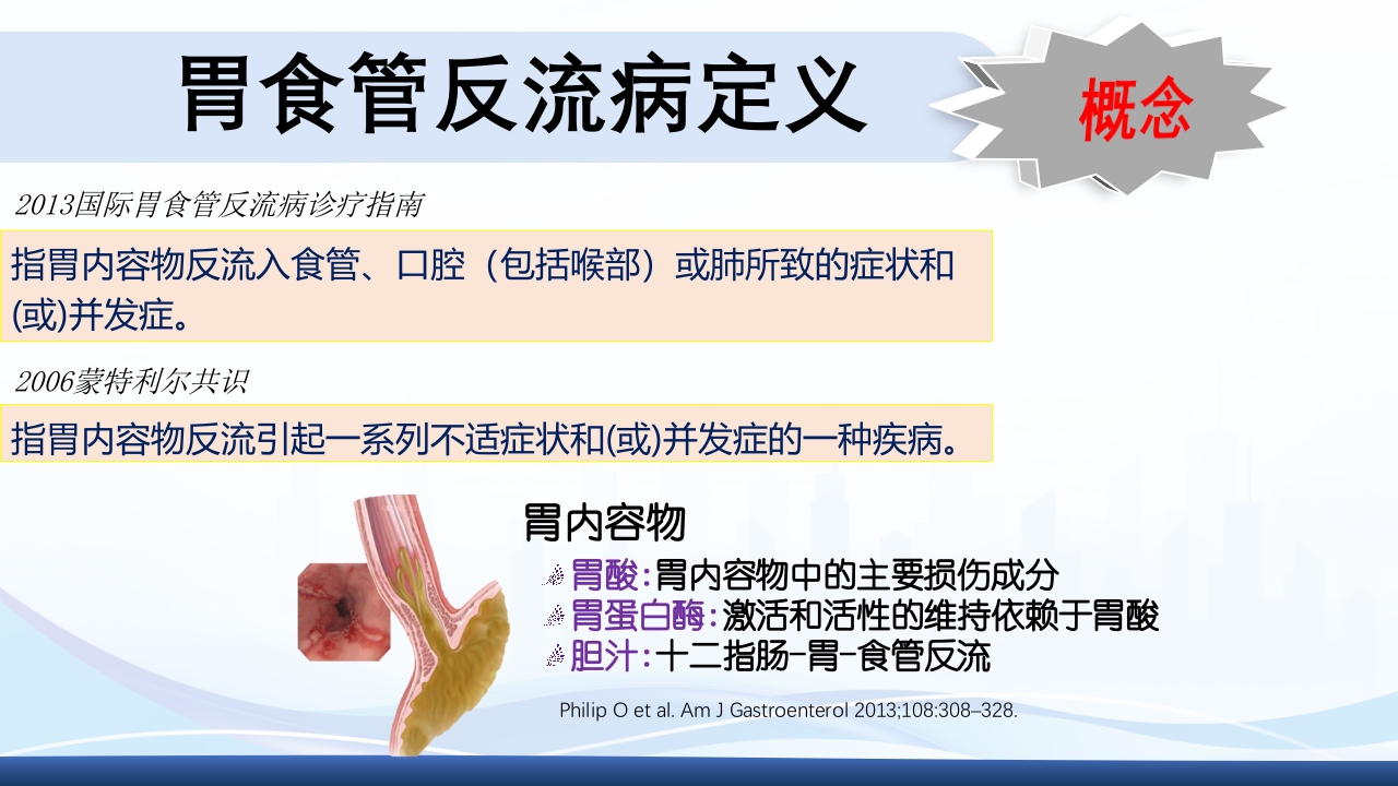 胃食管反流PPT课件3