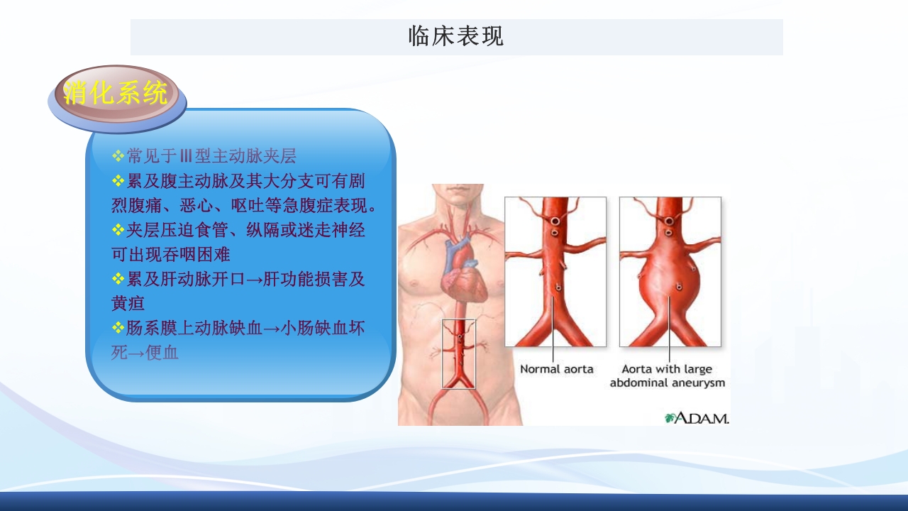 主动脉夹层护理查房PPT课件下载21