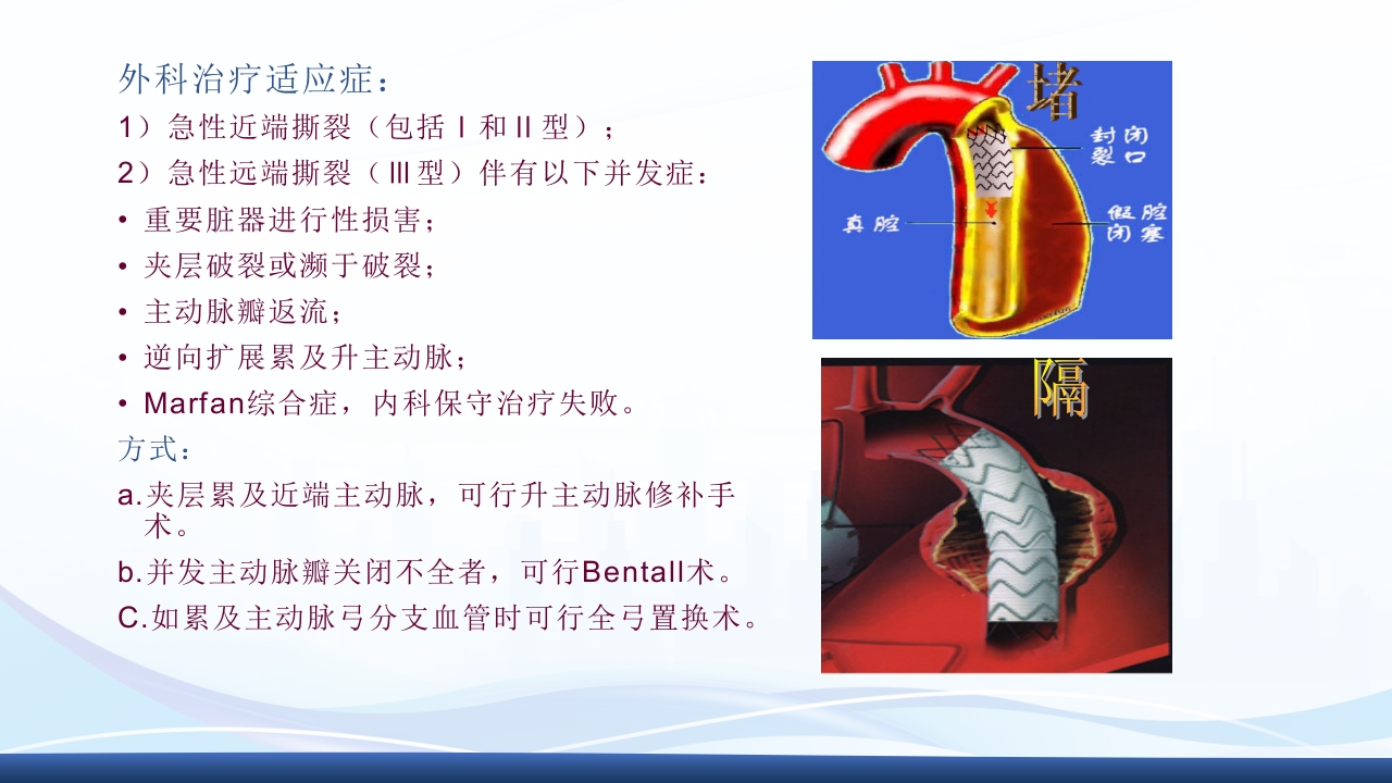 主动脉夹层护理查房PPT课件下载28