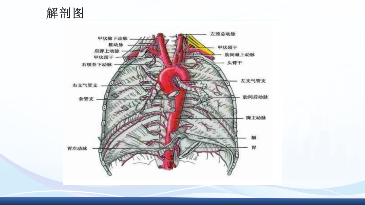 主动脉夹层护理查房PPT课件下载4