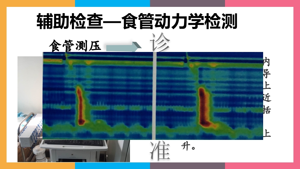 贲门失弛缓症治疗与护理PPT课件12