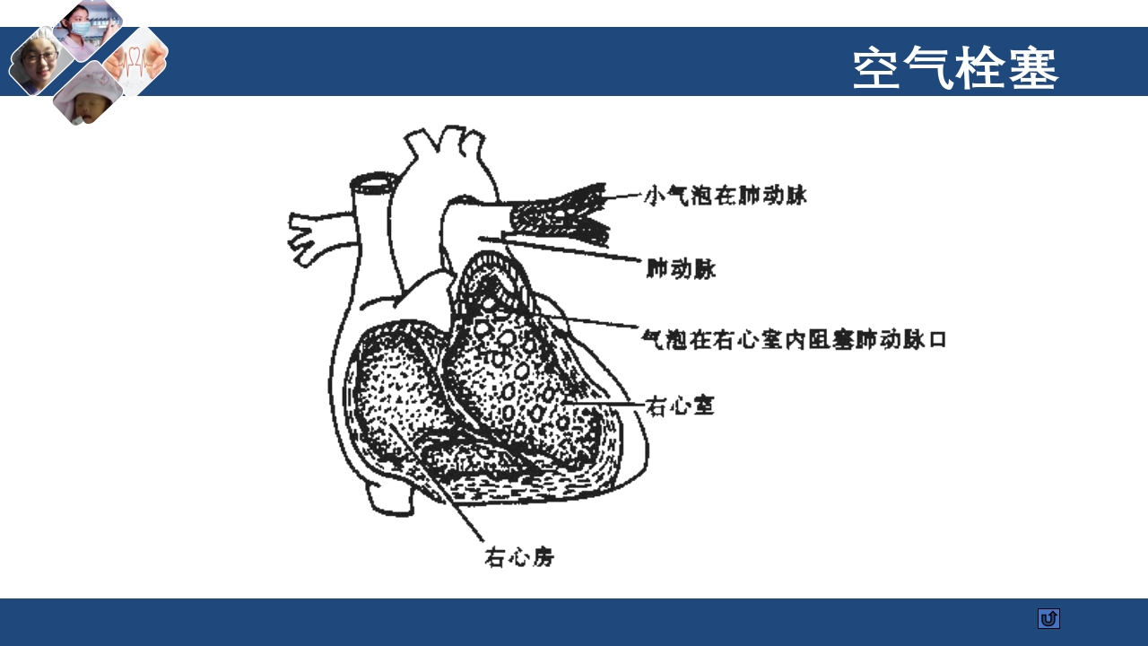 密闭式静脉输液技术PPT课件31