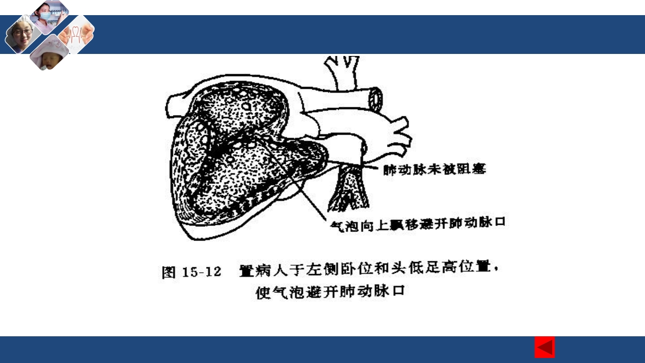 密闭式静脉输液技术PPT课件34