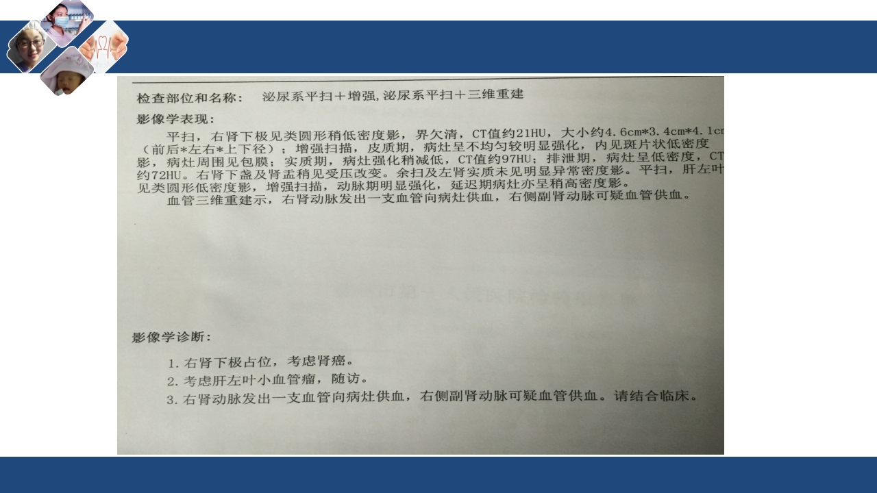 肾切除护理查房PPT课件下载13