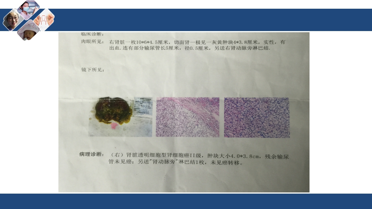 肾切除护理查房PPT课件下载18