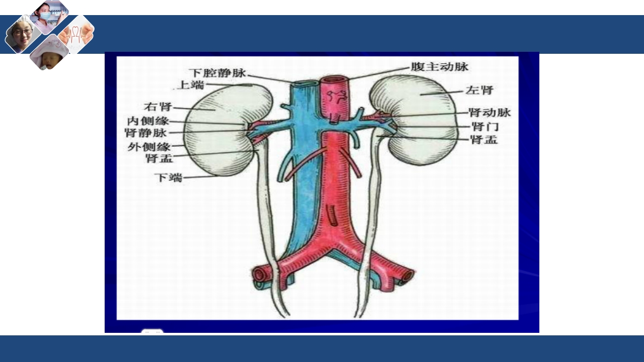 肾切除护理查房PPT课件下载3