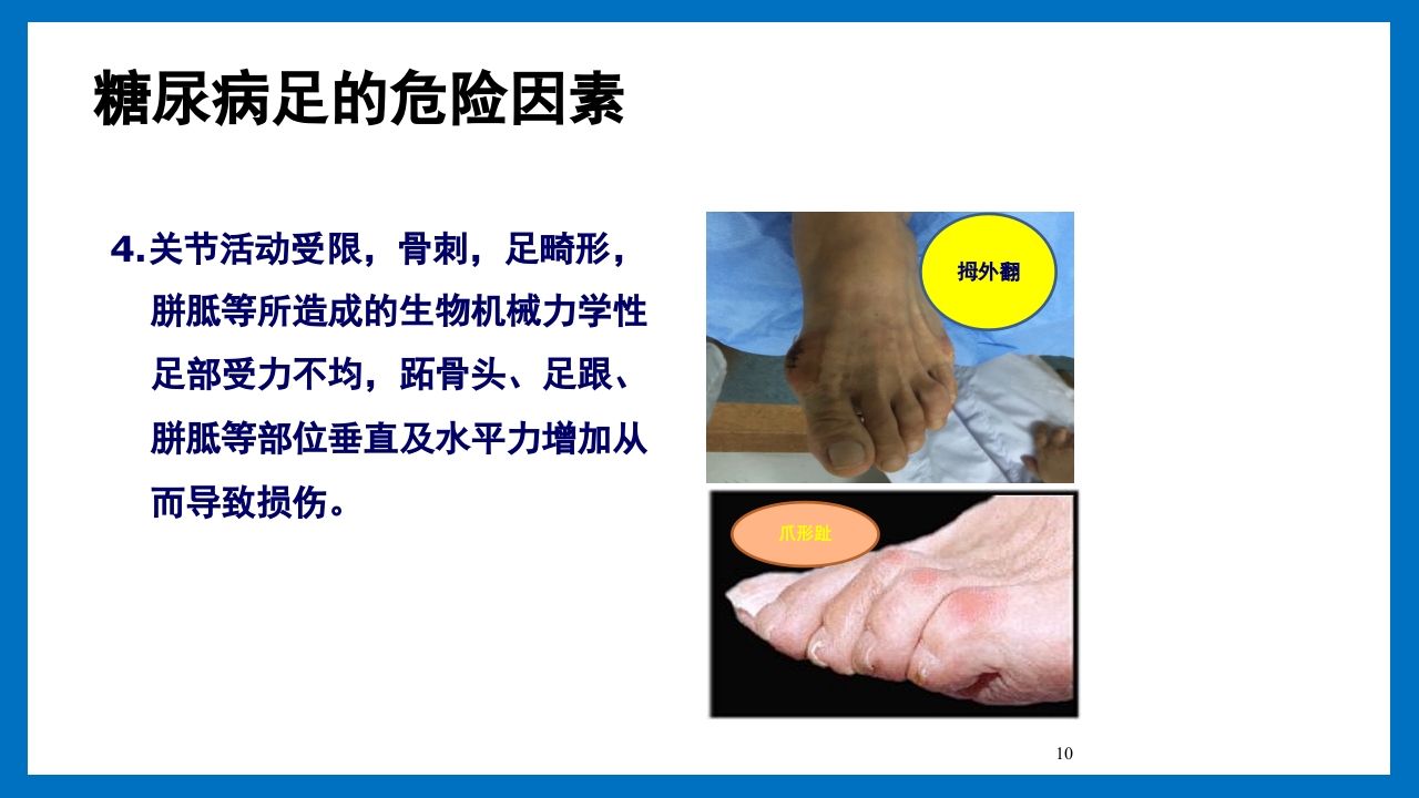 糖尿病足的预防和护理小讲课PPT11
