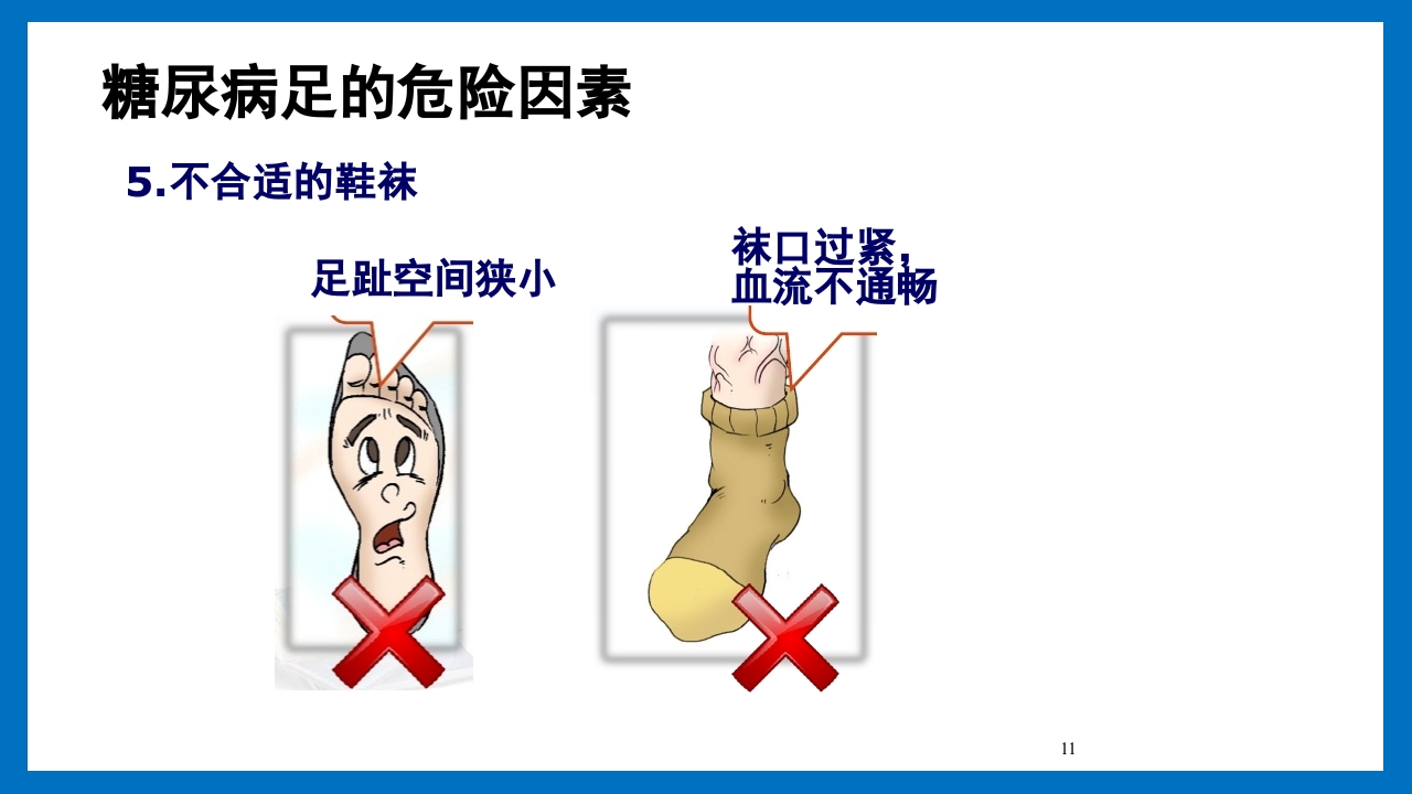 糖尿病足的预防和护理小讲课PPT12