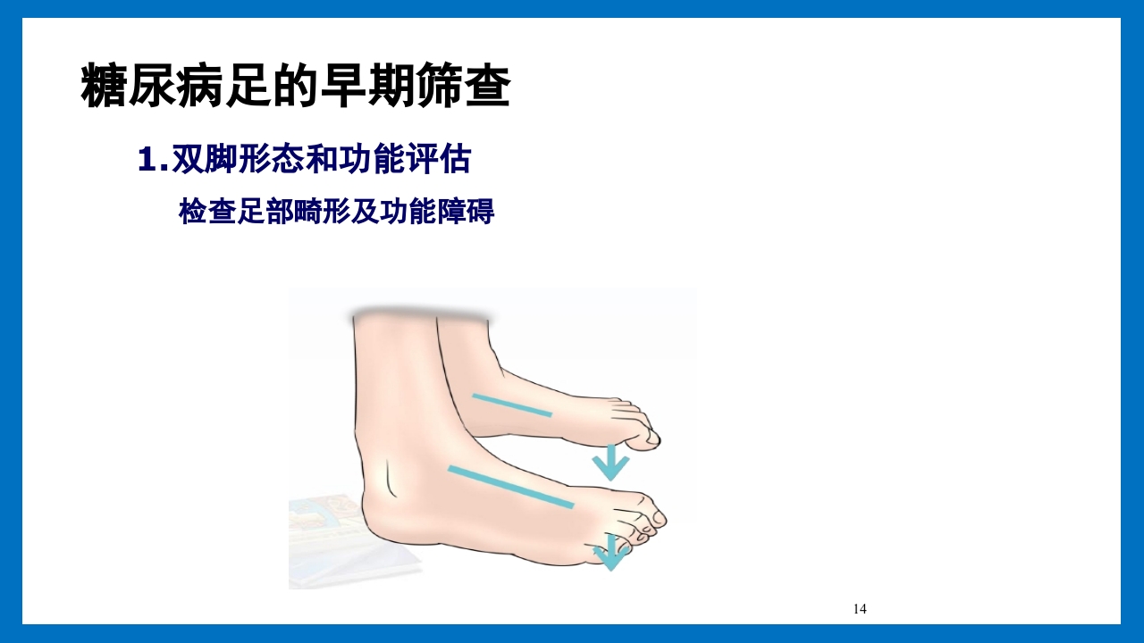 糖尿病足的预防和护理小讲课PPT16