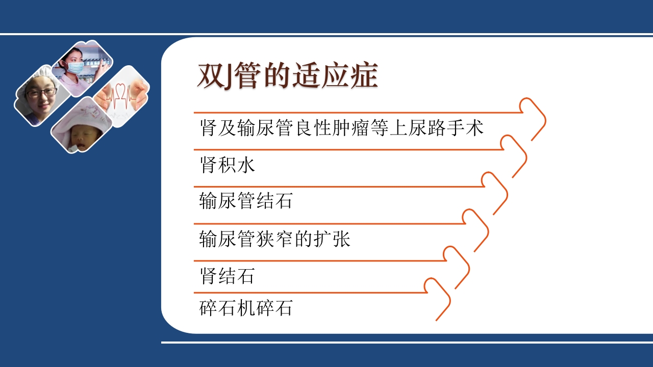 双J管的护理PPT课件6