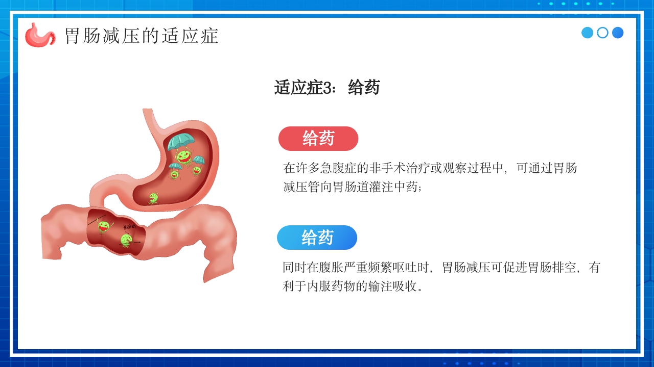 胃肠减压的护理PPT课件11