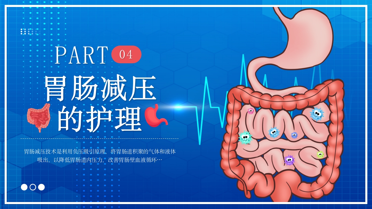 胃肠减压的护理PPT课件13