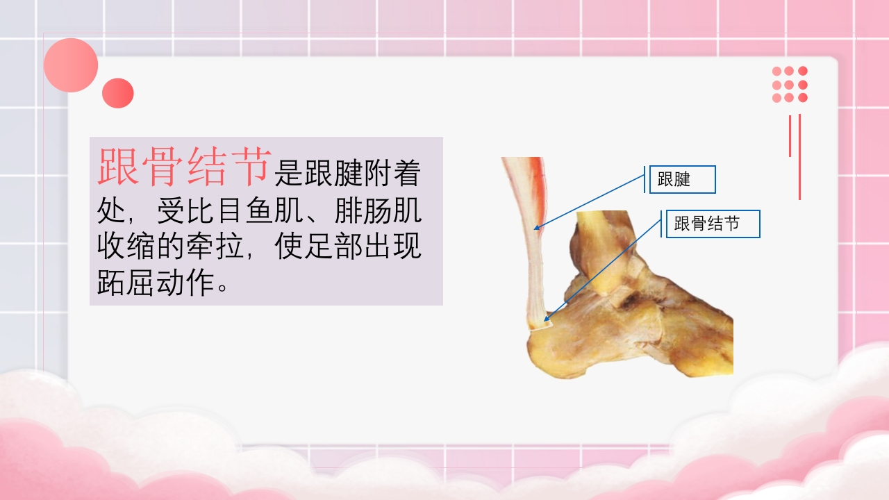 跟骨骨折个案护理PPT课件11