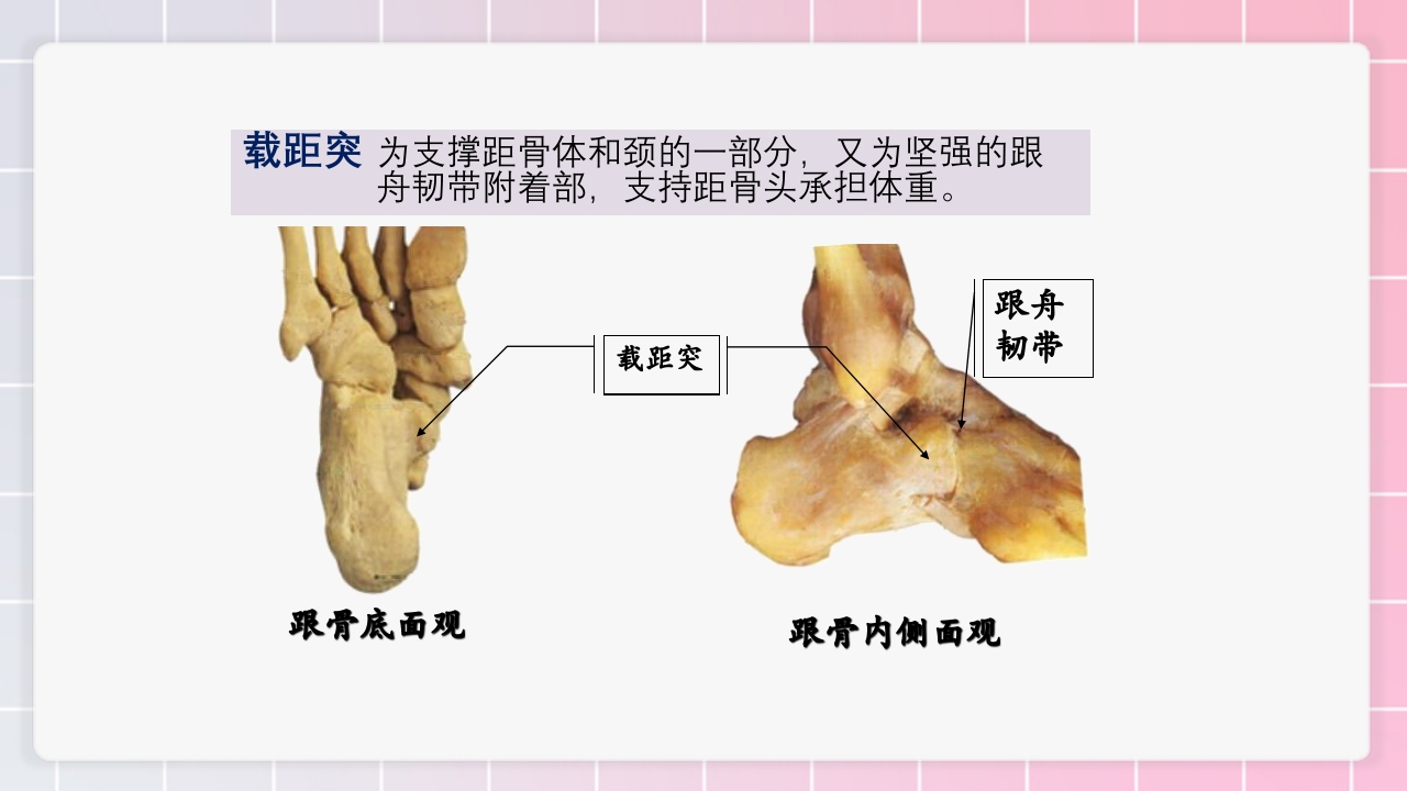 跟骨骨折个案护理PPT课件13