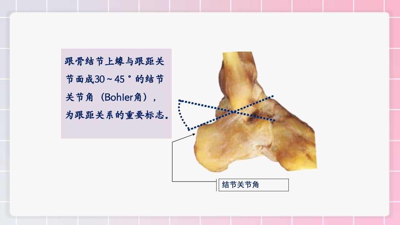 跟骨骨折个案护理PPT课件14