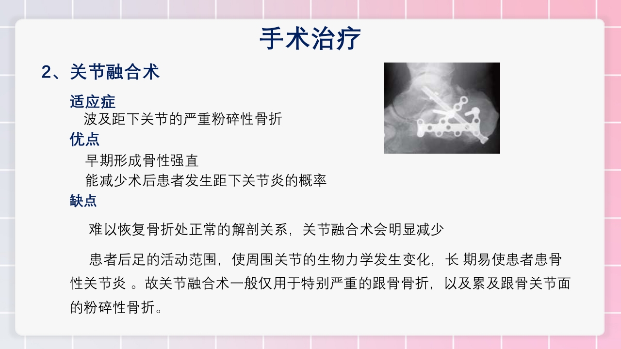 跟骨骨折个案护理PPT课件27