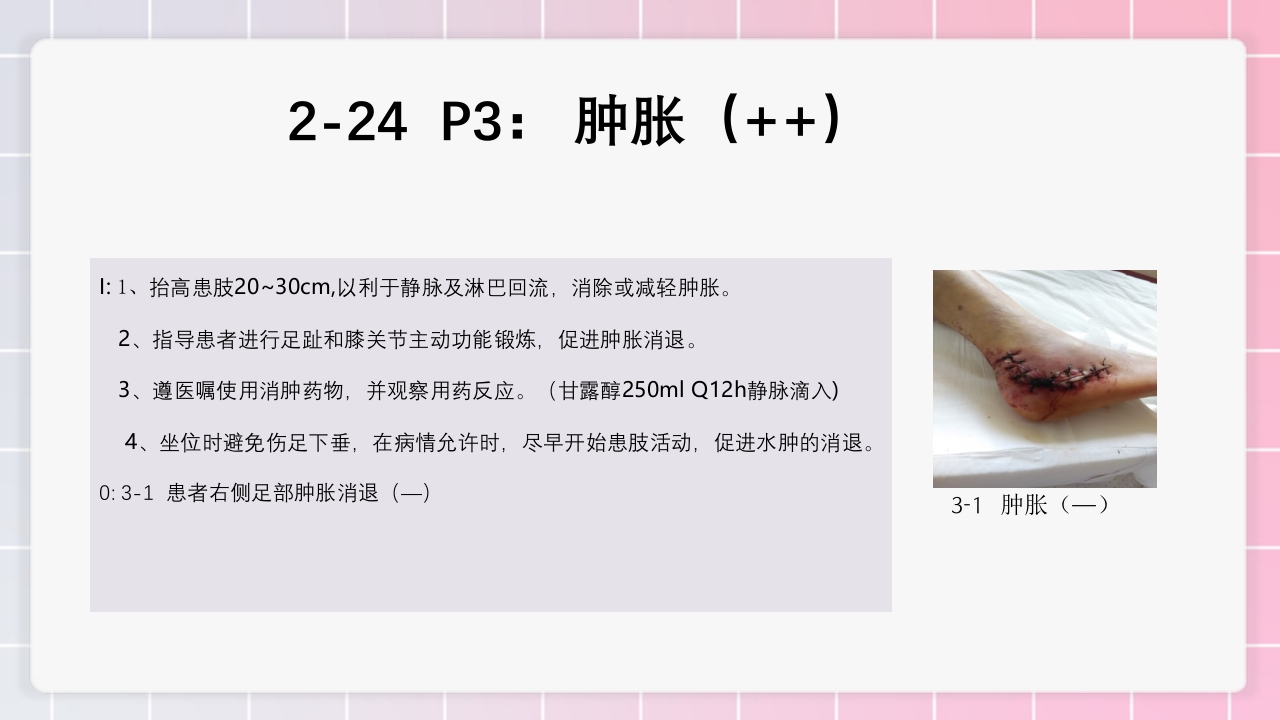 跟骨骨折个案护理PPT课件44