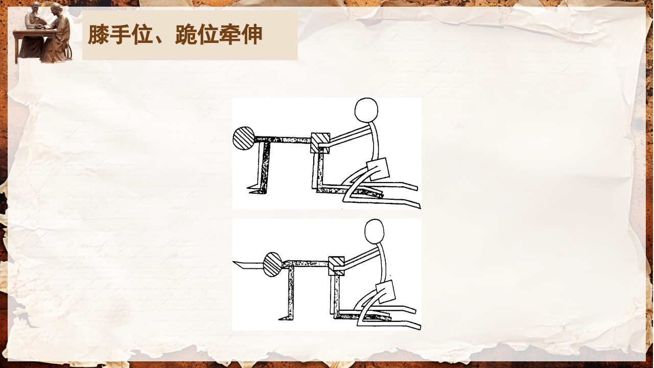 脑卒中的康复针灸理疗护理PPT课件56