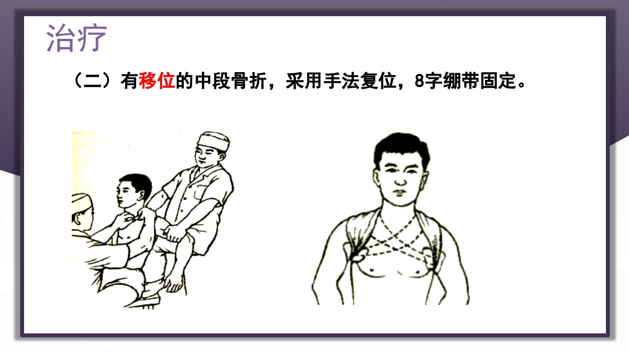 上肢骨关节损伤PPT课件11