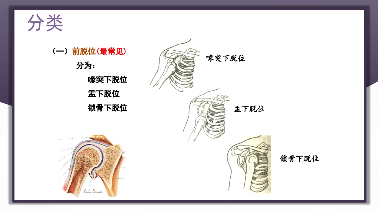 上肢骨关节损伤PPT课件14