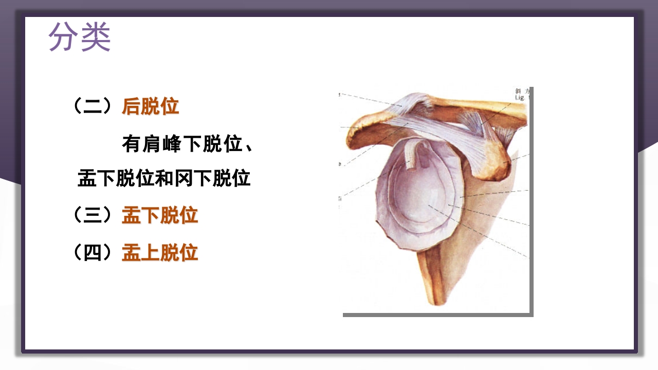 上肢骨关节损伤PPT课件15