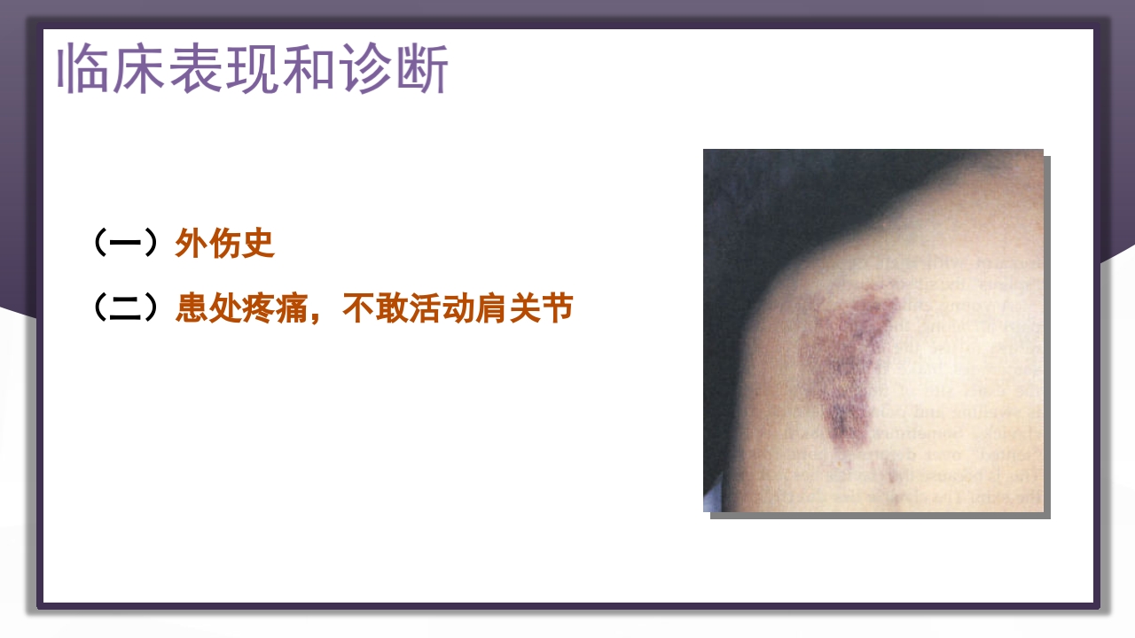 上肢骨关节损伤PPT课件16