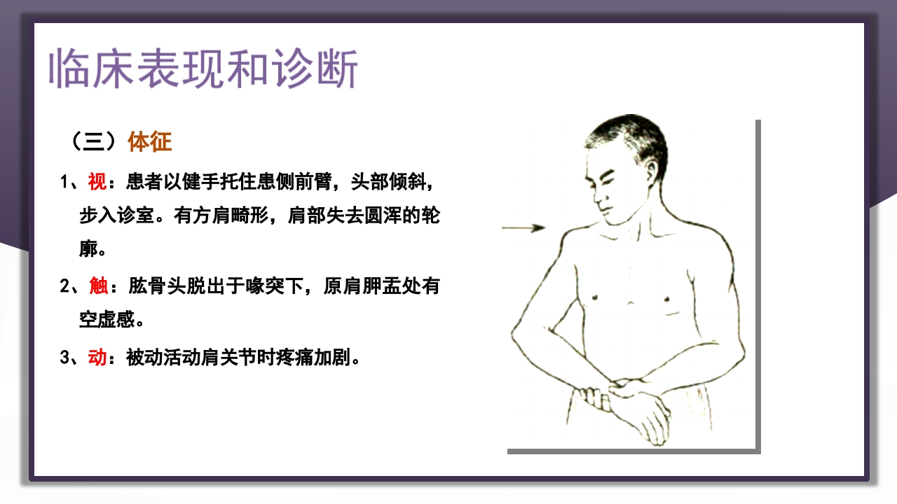 上肢骨关节损伤PPT课件18