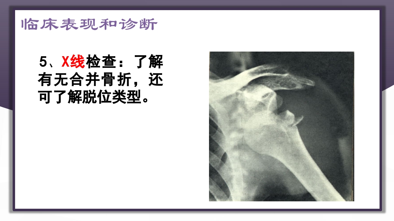 上肢骨关节损伤PPT课件20