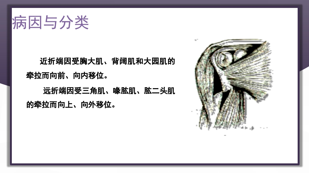 上肢骨关节损伤PPT课件26