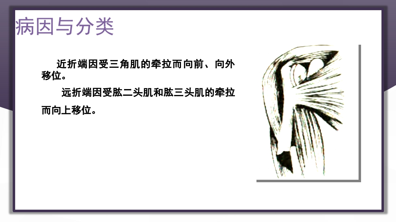 上肢骨关节损伤PPT课件27