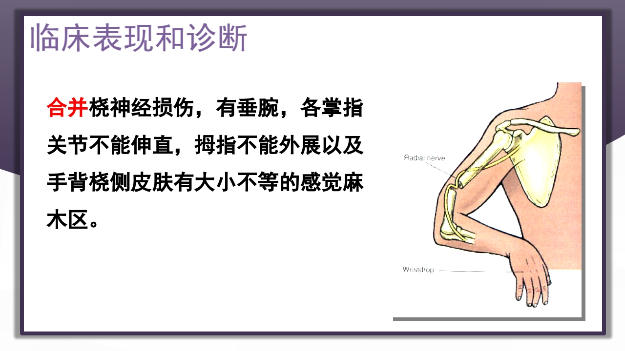 上肢骨关节损伤PPT课件30